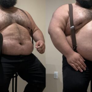Suspender Bloat Belches